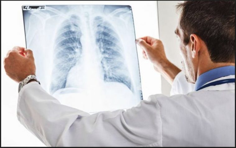 Hipertensiunea Pulmonara: Ce Este, Care Sunt Cauzele, Simptomele Si Ce ...